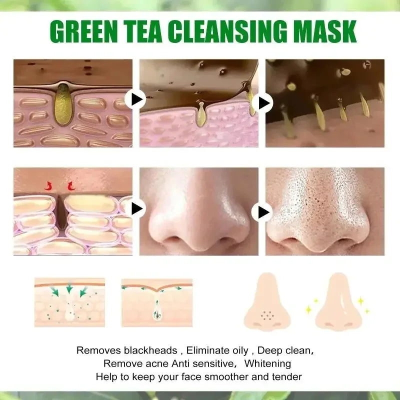 Fast Remove Blackhead - Green Tea Solid Mask