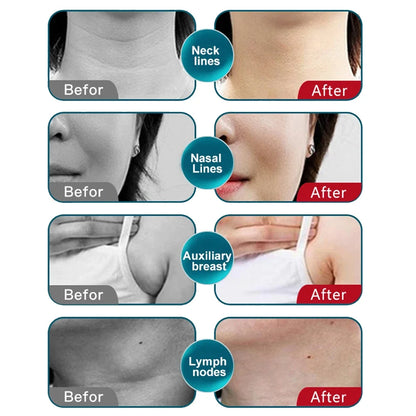 Korean Ritual: Electric Gua Sha Board Stone Facial Machine Vibration Massager